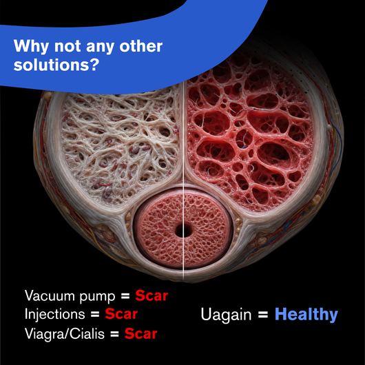 Uagain Prime Formula - Prevents Penile Scarring